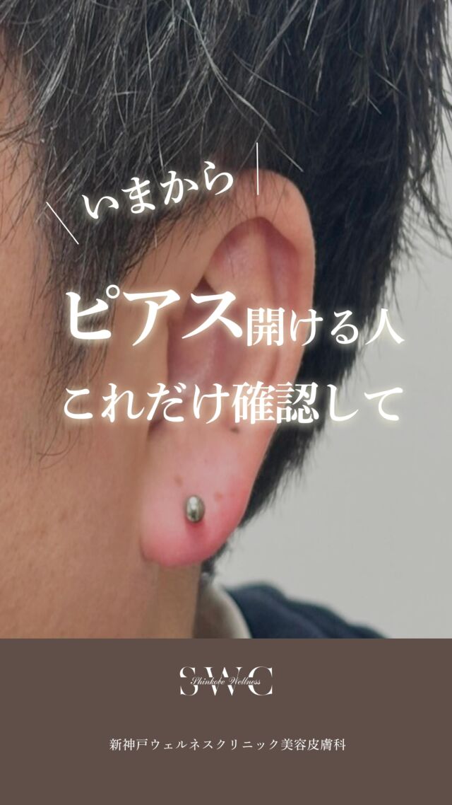 .
🌿新神戸ウェルネスクリニック美容皮膚科です🕊️

今回はピアスを開ける時の注意点についてです⚠️
一生残るかもしれないピアスホールですが、
位置・角度・ケアを間違えると
腫れ・化膿・色素沈着・しこりなど
トラブルは長く残ることもあります💦

▶ セルフピアス
・手軽にできる
・位置ズレや斜め穴になりやすい
・消毒やアフターケアは自己判断

▶ 医療機関でのピアス
・解剖学的に安全な位置を確認
・医療用ファーストピアスを使用
・滅菌環境で施術
・万が一のトラブルも医師対応

「開ける」だけなら、どこでもできる。
でもきれいに治るかどうかは、場所で決まります✨

おしゃれしたい気持ちを大事にしたいからこそ、
お客様には安心安全の施術をご提供いたします☺️

当院ではアレルギー対応ピアスを採用しております。

まずはお気軽に無料カウセリングをご予約ください💐

___________________________________

神戸市中央区北野1-1コトノハコ神戸1F
☎︎ 078-272-0711
市営地下鉄新神戸駅南改札口 徒歩1分
営業時間 9:00-19:00（電話受付9:00-17:00）
ANAクラウンプラザホテル神戸の駐車場ご利用可能
___________________________________

#関西クリニック#兵庫クリニック#ピアスデビュー#ピアス