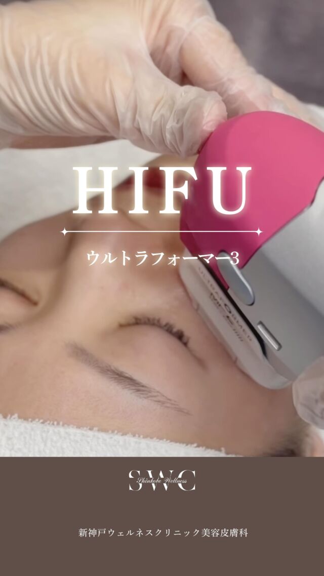 切らないリフトアップ『HIFU(ハイフ)』のご紹介です✨
当院ではウルトラフォーマー3の機械を導入しております。

🔹こんな方におすすめ🔹
・フェイスラインのたるみを引き締めたい
・小じわやほうれい線が気になる
・二重あごをすっきりさせたい
・肌質を改善したい
・ダウンタイムの少ない施術を受けたい
・メスを使う治療には抵抗がある

💆‍♀️HIFUは“切らないリフトアップ”として人気の施術。
肌を支える筋膜層まで熱エネルギーを届け、
コラーゲン生成を促進しながら、ハリ・弾力のあるお肌へ導きます。

年齢によるたるみやフェイスラインのもたつきが気になってきた方におすすめです✨

まずは無料カウセリングでお気軽にご相談ください💐

___________________________________

神戸市中央区北野1-1コトノハコ神戸1F
☎︎ 078-272-0711
市営地下鉄新神戸駅南改札口 徒歩1分
営業時間 9:00-19:00（電話受付9:00-17:00）
ANAクラウンプラザホテル神戸の駐車場ご利用可能
___________________________________

#ハイフ#HIFU#神戸美容クリニック#関西美容クリニック#たるみ