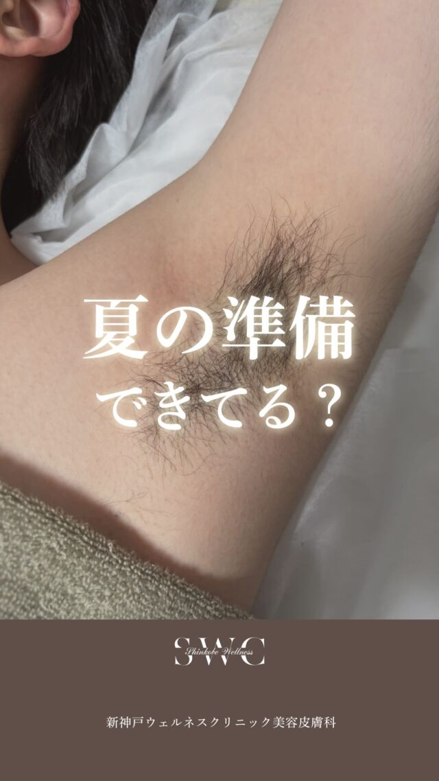 夏に向けて脱毛始めてみませんか？☀️🏄

当院では、厚労省＆FDA承認の
ジェントルマンマックスプロ2台に加え、
最新機器ジェントルマックスプロ プラスを1台を導入しています！

✔️ 2種類のレーザーであらゆる毛質にも色黒肌にも対応
✔️ 毛母細胞を破壊する熱破壊式脱毛
✔️ 痛みを抑える冷却システム
✔️ 大口径でスピーディー

こんな方におすすめ💡
・永久脱毛したい
・太い毛〜うぶ毛までしっかり脱毛したい
・色黒肌でも安心して脱毛したい
・脱毛＋美白・美肌も叶えたい

※麻酔について
痛みに強い部位は麻酔使用可能です✨
心配な方はご利用ください♪

神戸三宮エリア最安水準でご提供中✨
ぜひ一度お試しください😊

___________________________________

神戸市中央区北野1-1コトノハコ神戸1F
☎︎ 078-272-0711
市営地下鉄新神戸駅南改札口 徒歩1分
営業時間 9:00-19:00（電話受付9:00-17:00）
ANAクラウンプラザホテル神戸の駐車場ご利用可能
___________________________________

#脱毛#肌質改善#美肌ケア#医療脱毛#ジェントルマックスプロ